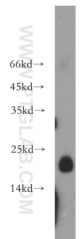 Claudin 3 Polyclonal antibody