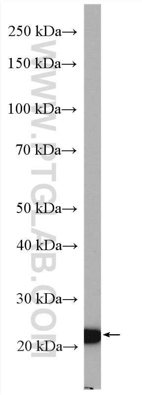 Western Blot (WB) analysis of MDA-MB-453s cells using Claudin 4-specific Polyclonal antibody (16195-1-AP)