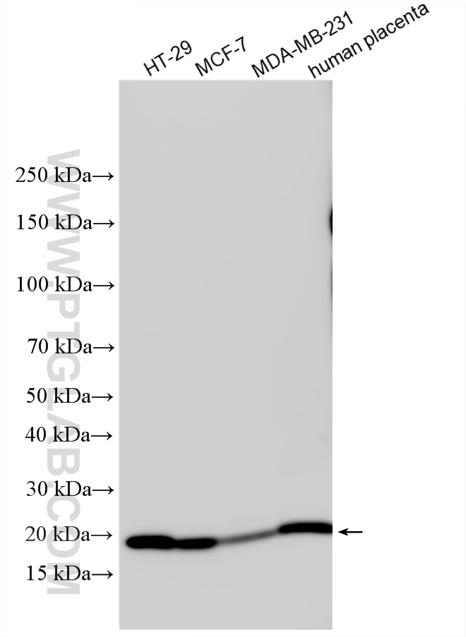 Various lysates were subjected to SDS PAGE followed by western blot with 16195-1-AP (Claudin 4-specific antibody) at dilution of 1:6000 incubated at room temperature for 1.5 hours. Western Blot (WB) analysis of various lysates using Claudin 4-specific Polyclonal antibody (16195-1-AP)