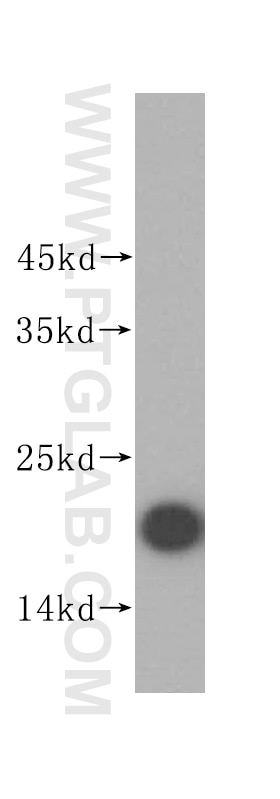 Western Blot (WB) analysis of human placenta tissue using Claudin 4-specific Polyclonal antibody (16195-1-AP)