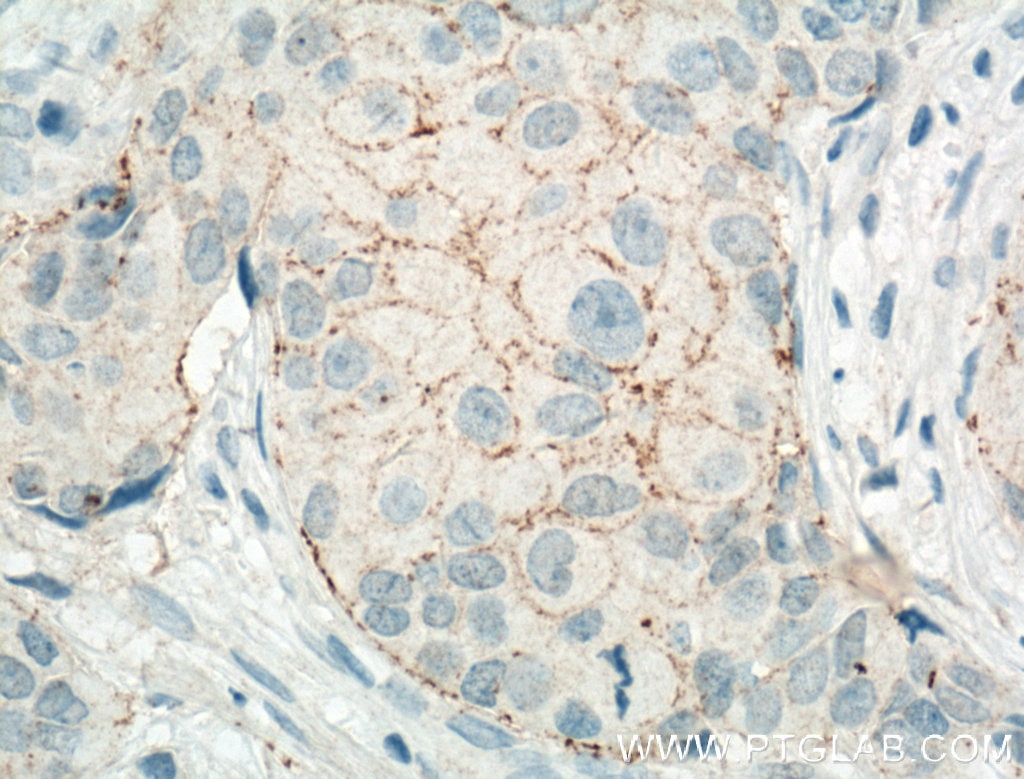 Claudin 7 Polyclonal antibody