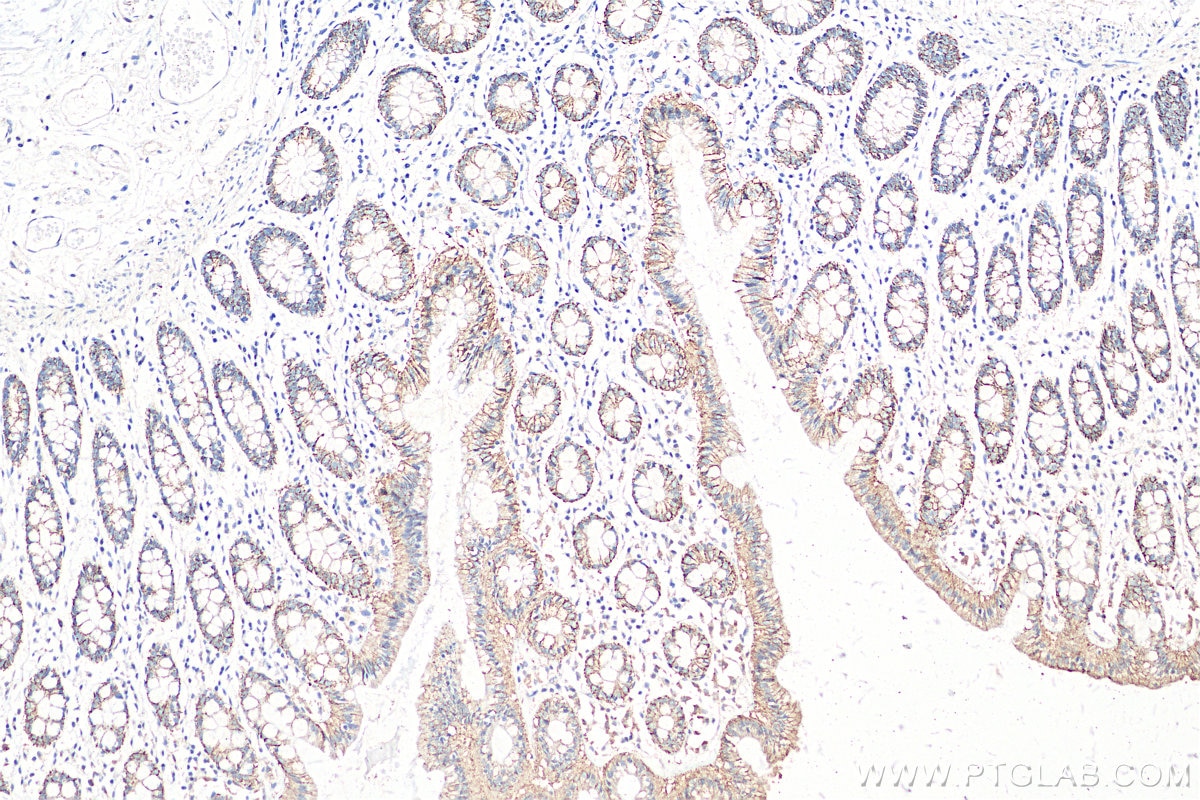 Immunohistochemistry (IHC) staining of human colon tissue using Claudin 7 Polyclonal antibody (29795-1-AP)