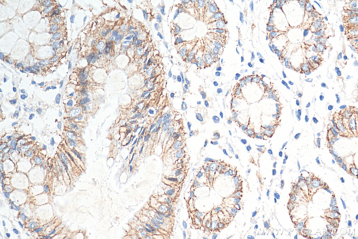 Immunohistochemistry (IHC) staining of human colon tissue using Claudin 7 Polyclonal antibody (29795-1-AP)