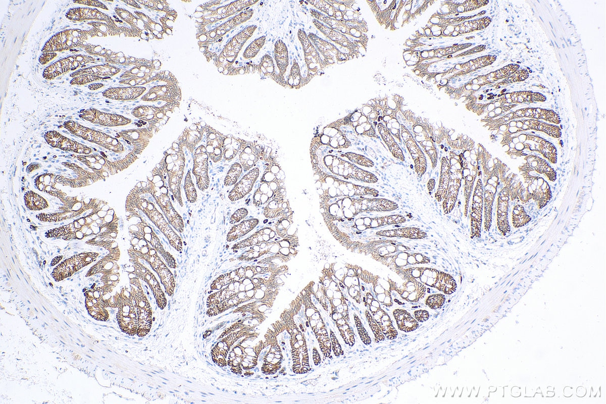 Immunohistochemistry (IHC) staining of mouse colon tissue using Claudin 7 Polyclonal antibody (29795-1-AP)