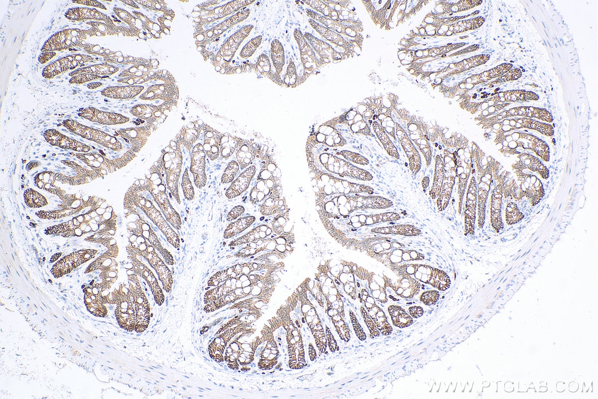 IHC staining of mouse colon using 29795-1-AP