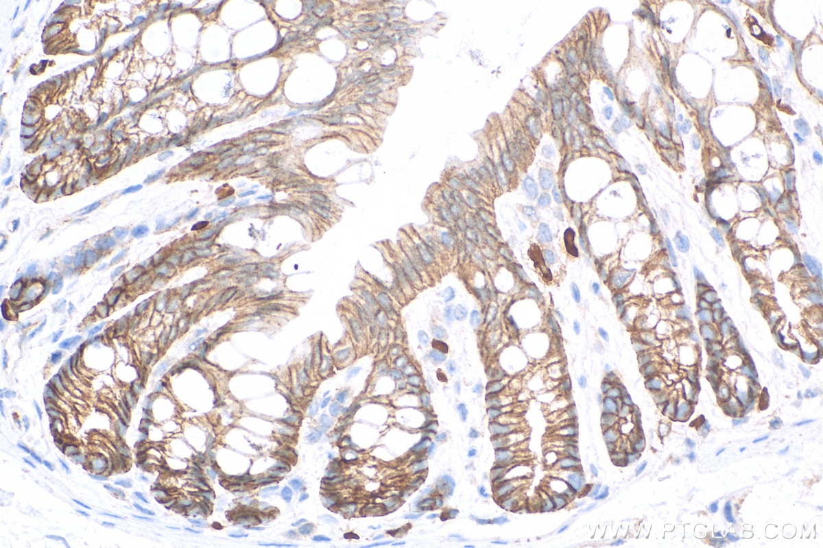 Immunohistochemistry (IHC) staining of mouse colon tissue using Claudin 7 Polyclonal antibody (29795-1-AP)