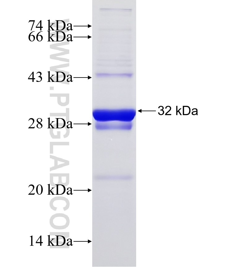 CLDN7 fusion protein Ag31706 SDS-PAGE