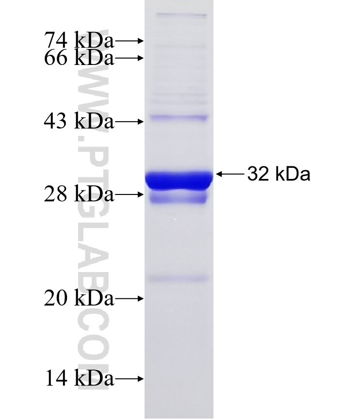 CLDN7 fusion protein Ag31706 SDS-PAGE