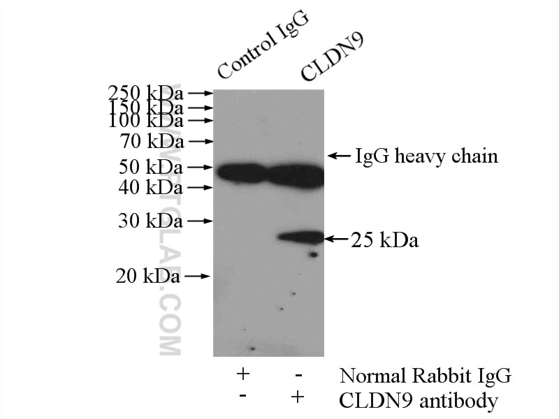 Immunoprecipitation (IP) experiment of HeLa cells using Claudin 9-specific Polyclonal antibody (16196-1-AP)