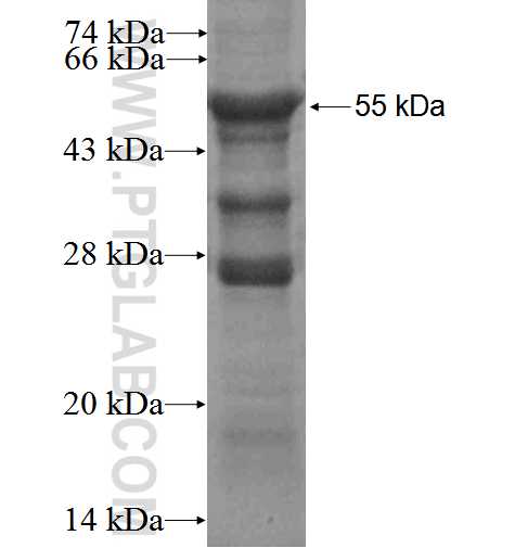 CLDND1 fusion protein Ag3211 SDS-PAGE