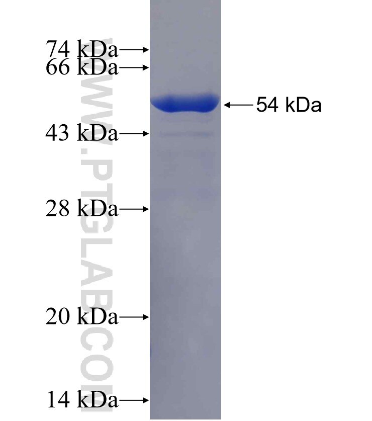 CLE; C14orf166 fusion protein Ag13900 SDS-PAGE