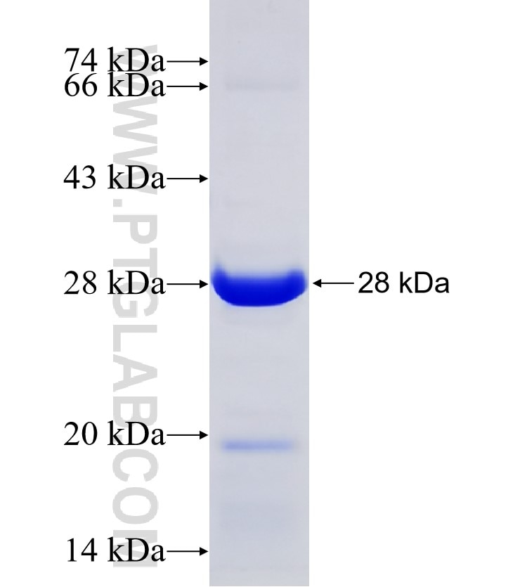 CLE; C14orf166 fusion protein Ag13948 SDS-PAGE