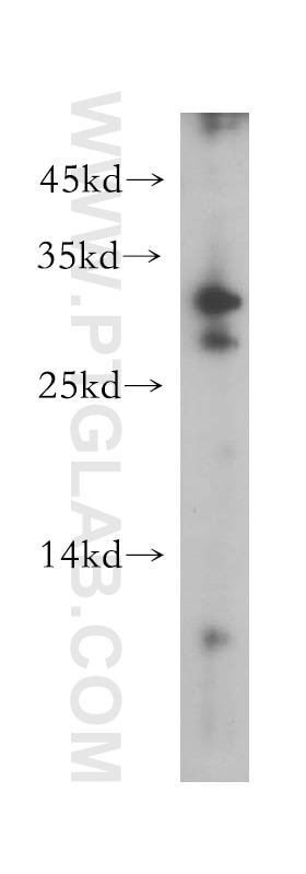 Western Blot (WB) analysis of BxPC-3 cells using CLEC10A/CD301 Polyclonal antibody (13590-1-AP)