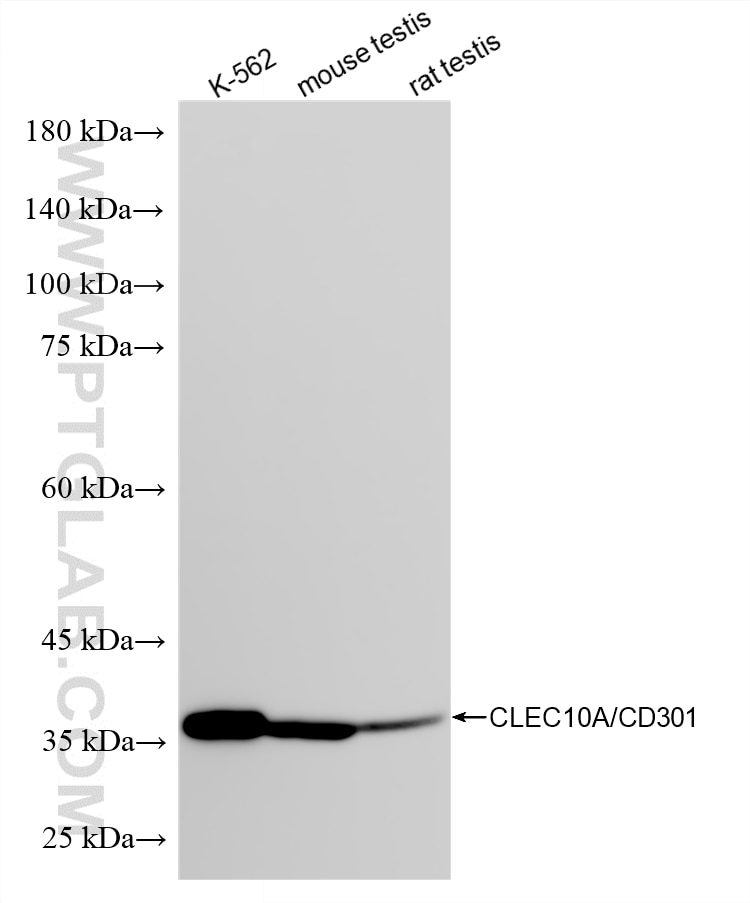 Western Blot (WB) analysis of various lysates using CLEC10A/CD301 Recombinant monoclonal antibody (84748-1-RR)