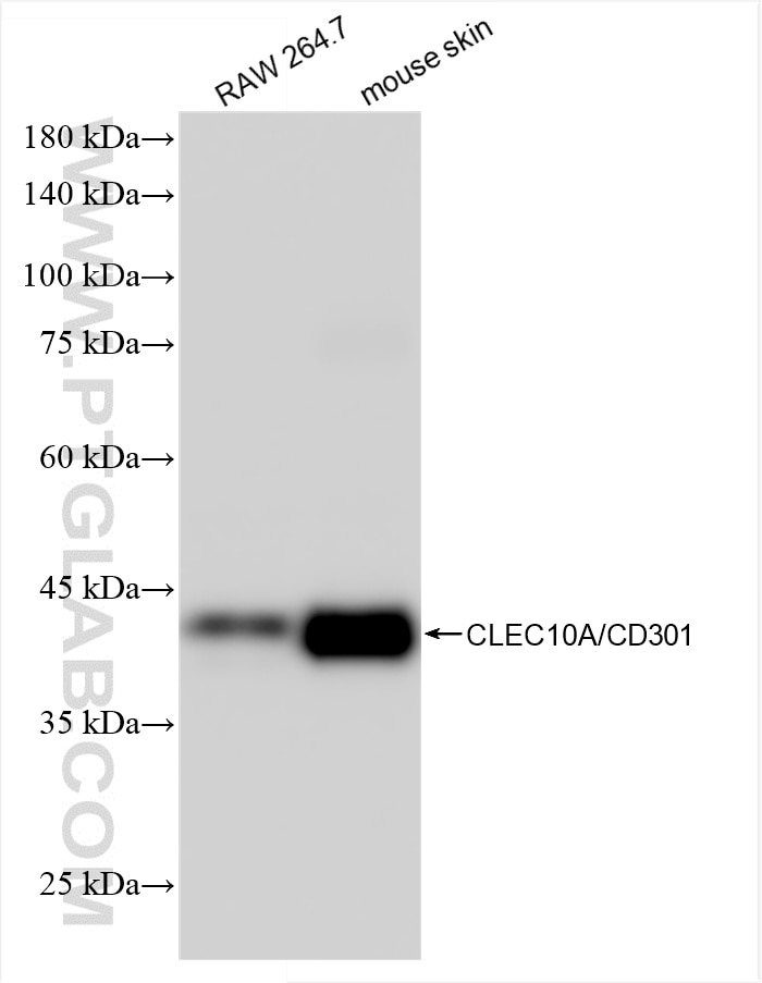 Western Blot (WB) analysis of RAW 264.7 cells using CLEC10A/CD301 Recombinant antibody (85911-5-RR)