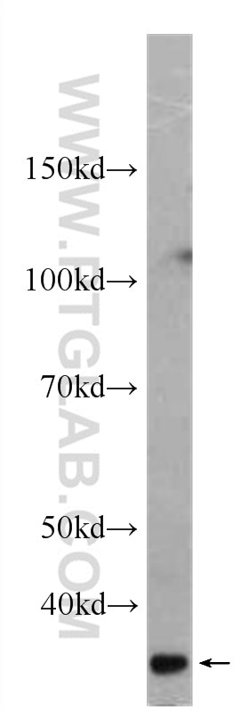 Western Blot (WB) analysis of human heart tissue using SCGF Monoclonal antibody (60295-1-Ig)