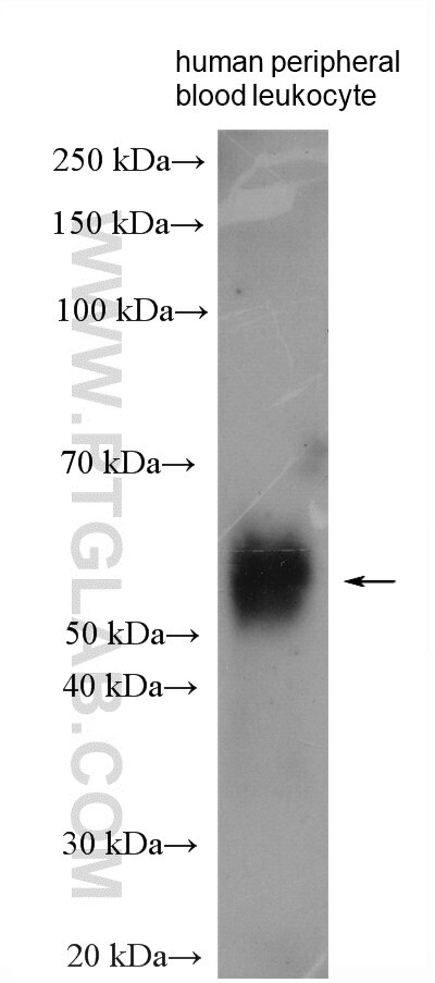 Western Blot (WB) analysis of various lysates using CLEC12A Polyclonal antibody (28627-1-AP)