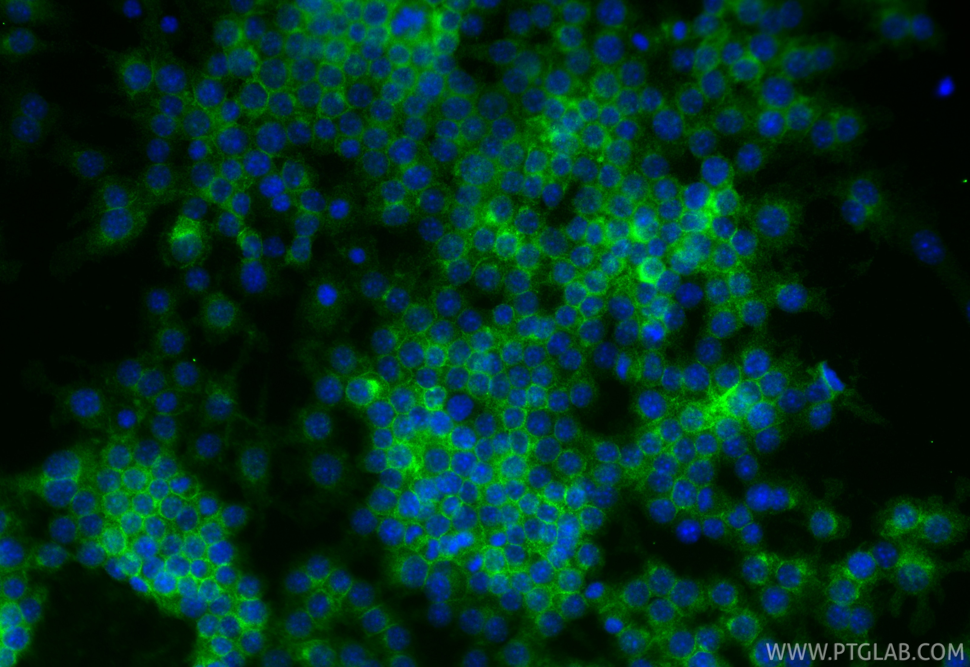 IF Staining of RAW 264.7 using 98357-1-RR (same clone as 98357-1-PBS) Immunofluorescence (IF) / fluorescent staining of RAW 264.7 cells using Anti-Mouse CLEC12A/CD371 Rabbit Recombinant Antibo (98357-1-RR)