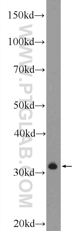 Western Blot (WB) analysis of mouse spleen tissue using CLEC12B Polyclonal antibody (26077-1-AP)