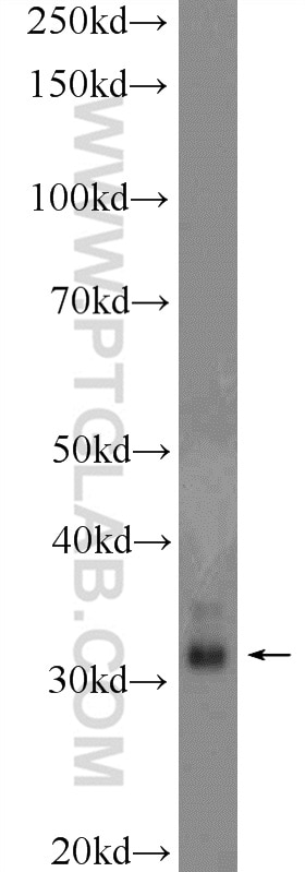 Western Blot (WB) analysis of rat brain tissue using CLEC12B Polyclonal antibody (26077-1-AP)
