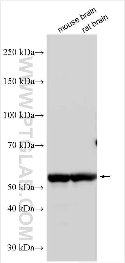 Western Blot (WB) analysis of various lysates using CLEC14A Polyclonal antibody (23964-1-AP)
