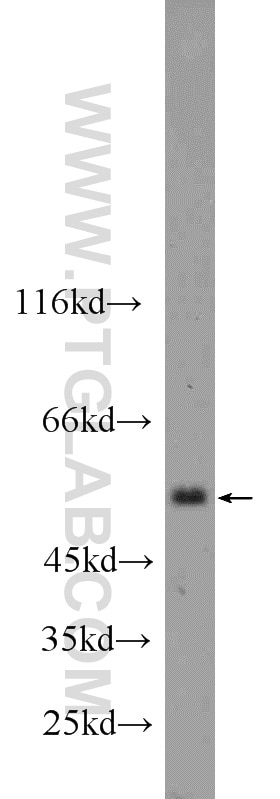 Western Blot (WB) analysis of mouse skeletal muscle tissue using CLEC14A Polyclonal antibody (23964-1-AP)