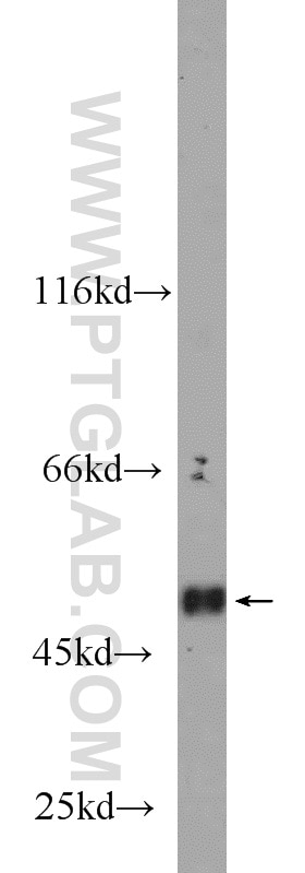 Western Blot (WB) analysis of human heart tissue using CLEC14A Polyclonal antibody (23964-1-AP)