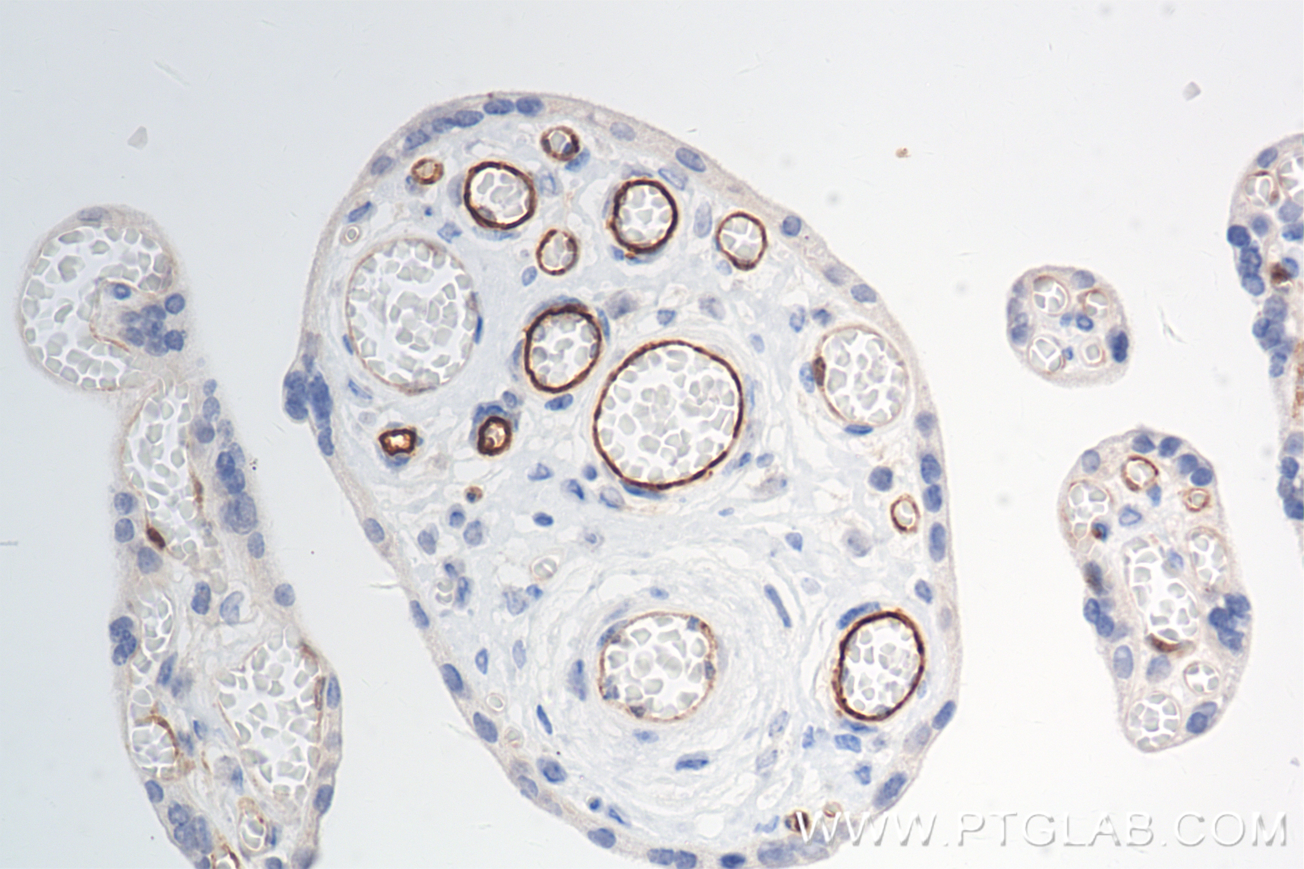 Immunohistochemistry (IHC) staining of human placenta tissue using CLEC14A Recombinant antibody (84327-1-RR)