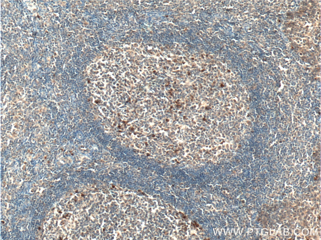 Immunohistochemistry (IHC) staining of human tonsillitis tissue using CLEC16A Polyclonal antibody (26257-1-AP)