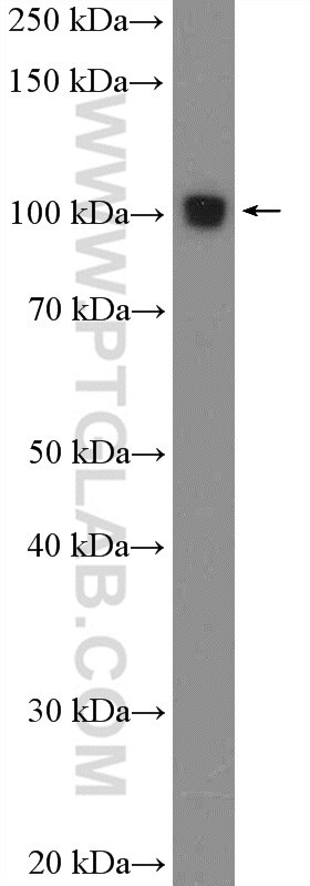 WB analysis of mouse spleen using 26257-1-AP