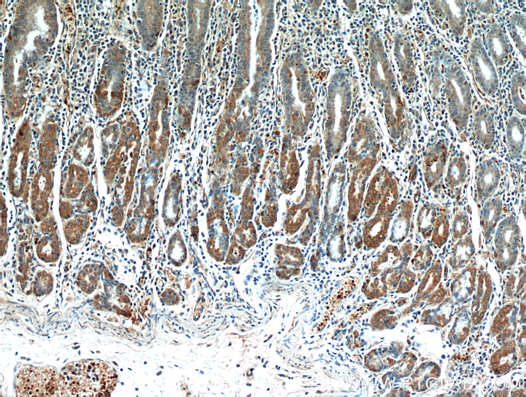 Immunohistochemistry (IHC) staining of human stomach tissue using CLEC18A Polyclonal antibody (21013-1-AP)