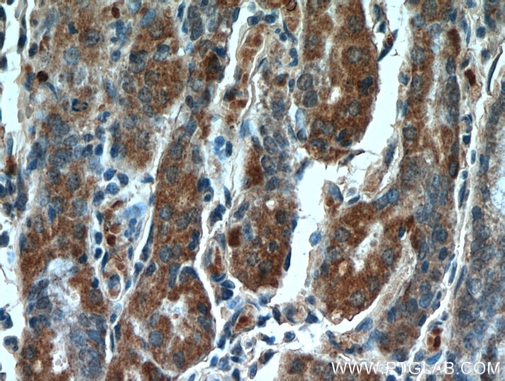 IHC staining of human stomach using 21013-1-AP