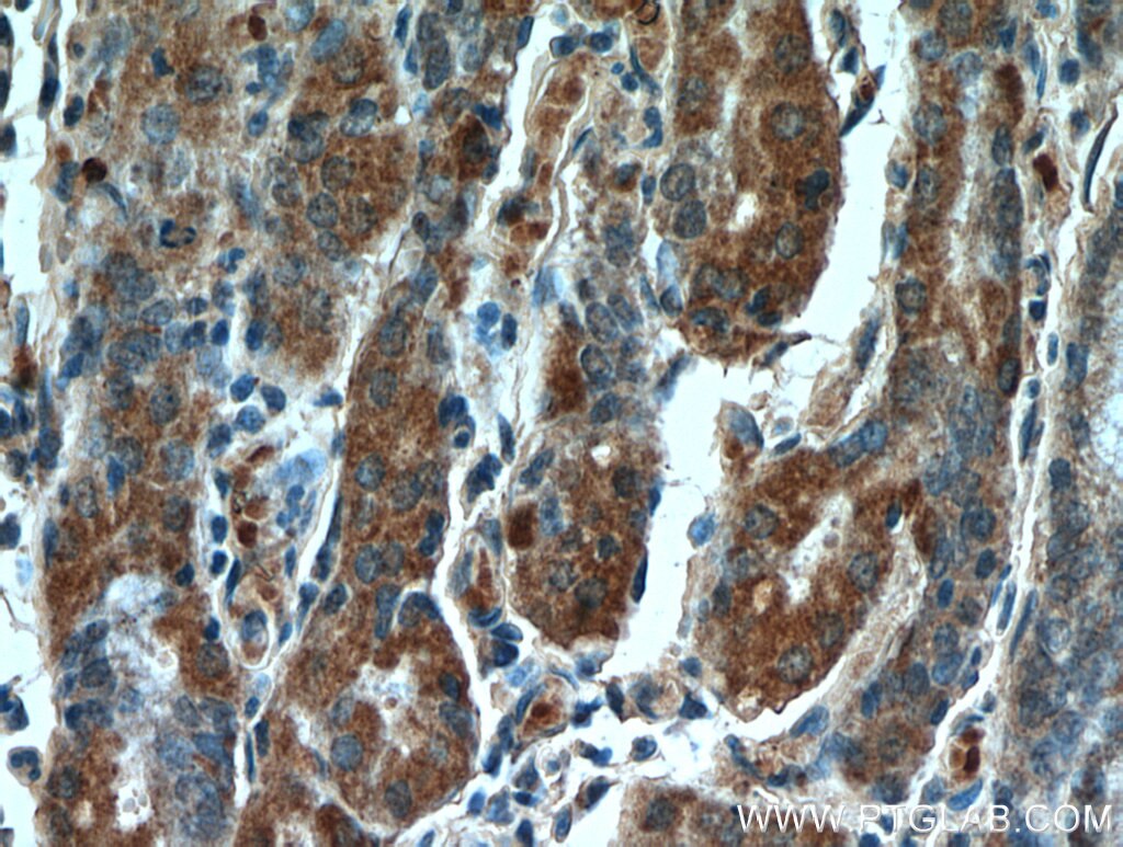 Immunohistochemistry (IHC) staining of human stomach tissue using CLEC18A Polyclonal antibody (21013-1-AP)