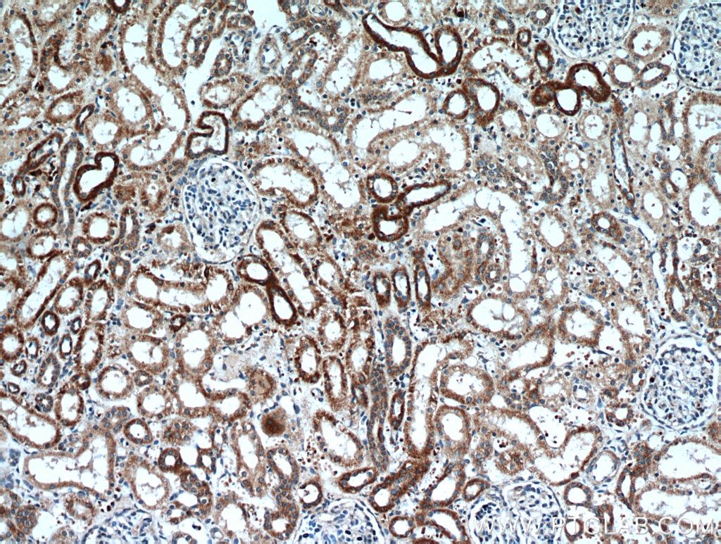 Immunohistochemistry (IHC) staining of human kidney tissue using CLEC18A Polyclonal antibody (21013-1-AP)