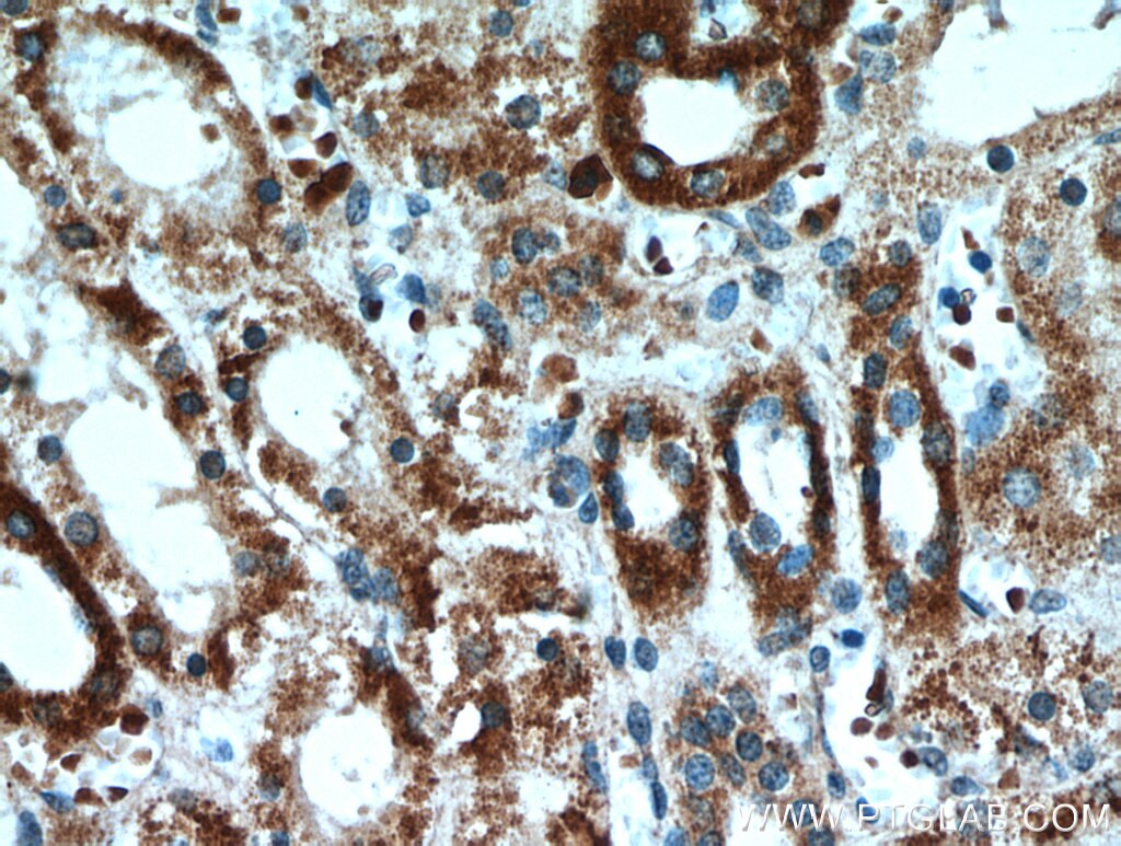 Immunohistochemistry (IHC) staining of human kidney tissue using CLEC18A Polyclonal antibody (21013-1-AP)