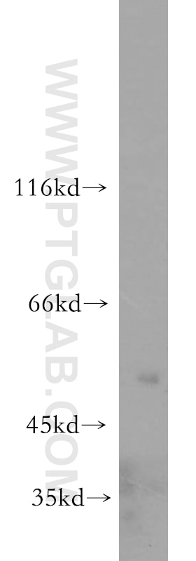 Western Blot (WB) analysis of HeLa cells using CLEC18A Polyclonal antibody (21013-1-AP)