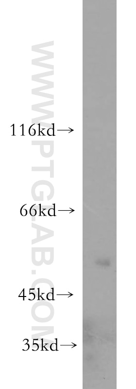 WB analysis of HeLa using 21013-1-AP