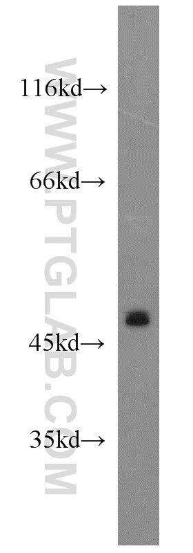 Western Blot (WB) analysis of HeLa cells using CLEC18A Polyclonal antibody (21013-1-AP)