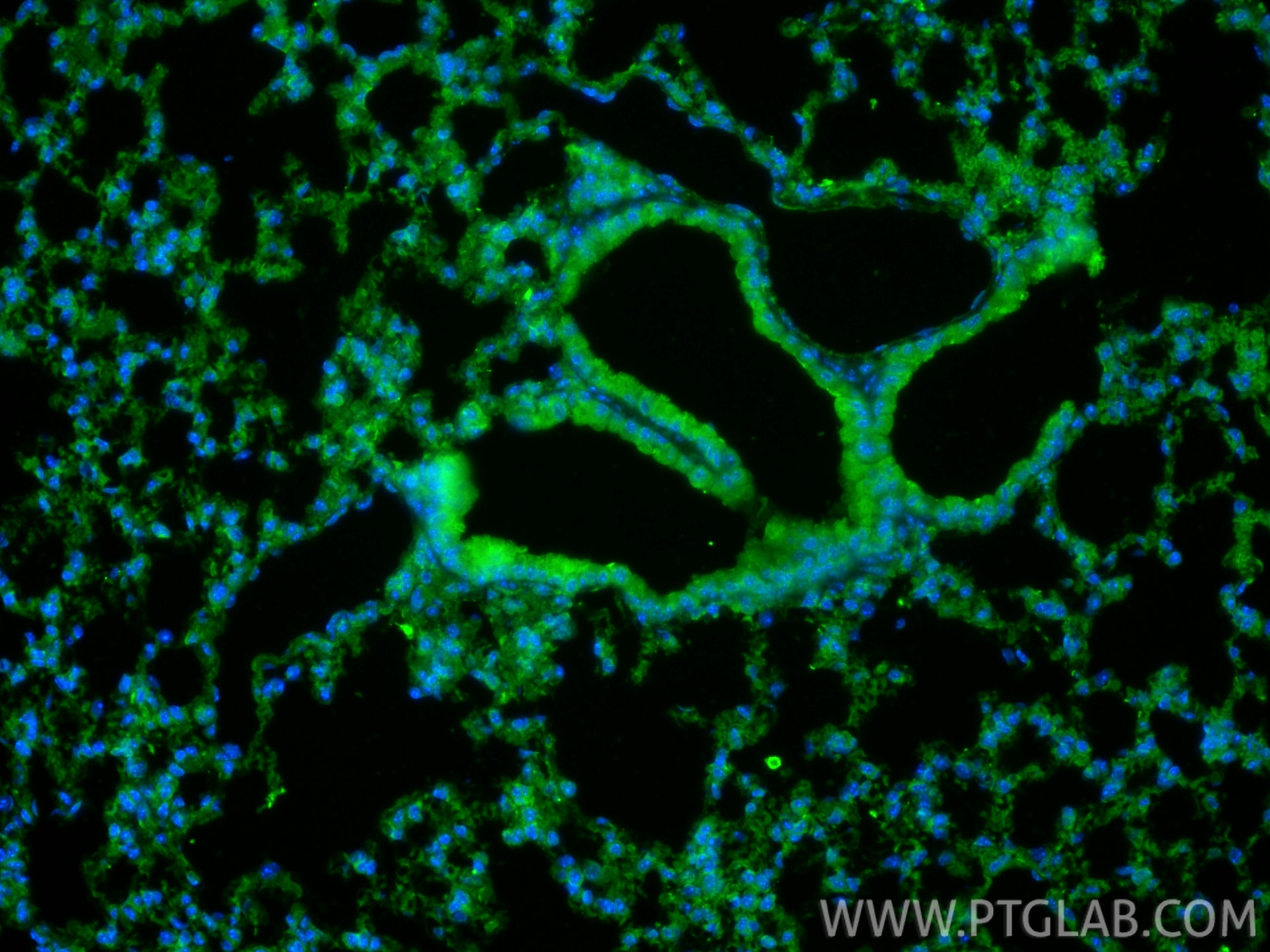 Immunofluorescence (IF) / fluorescent staining of mouse lung tissue using CLEC1A Polyclonal antibody (13394-1-AP)