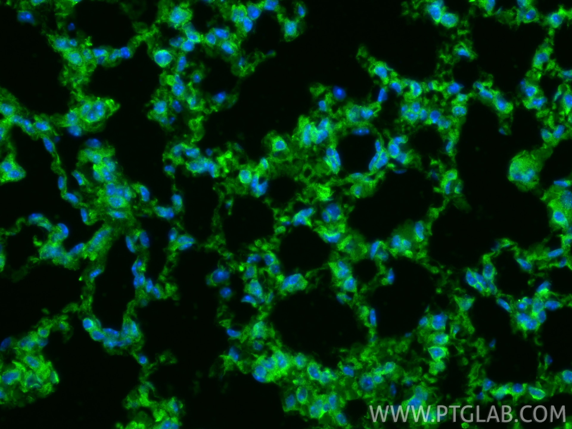 Immunofluorescence (IF) / fluorescent staining of mouse lung tissue using CLEC1A Polyclonal antibody (13394-1-AP)