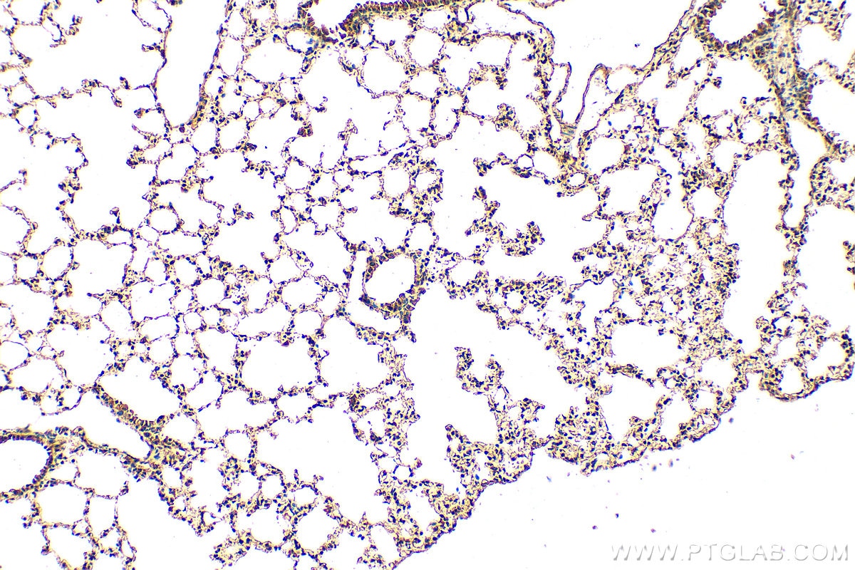 IHC staining of mouse lung using 13394-1-AP