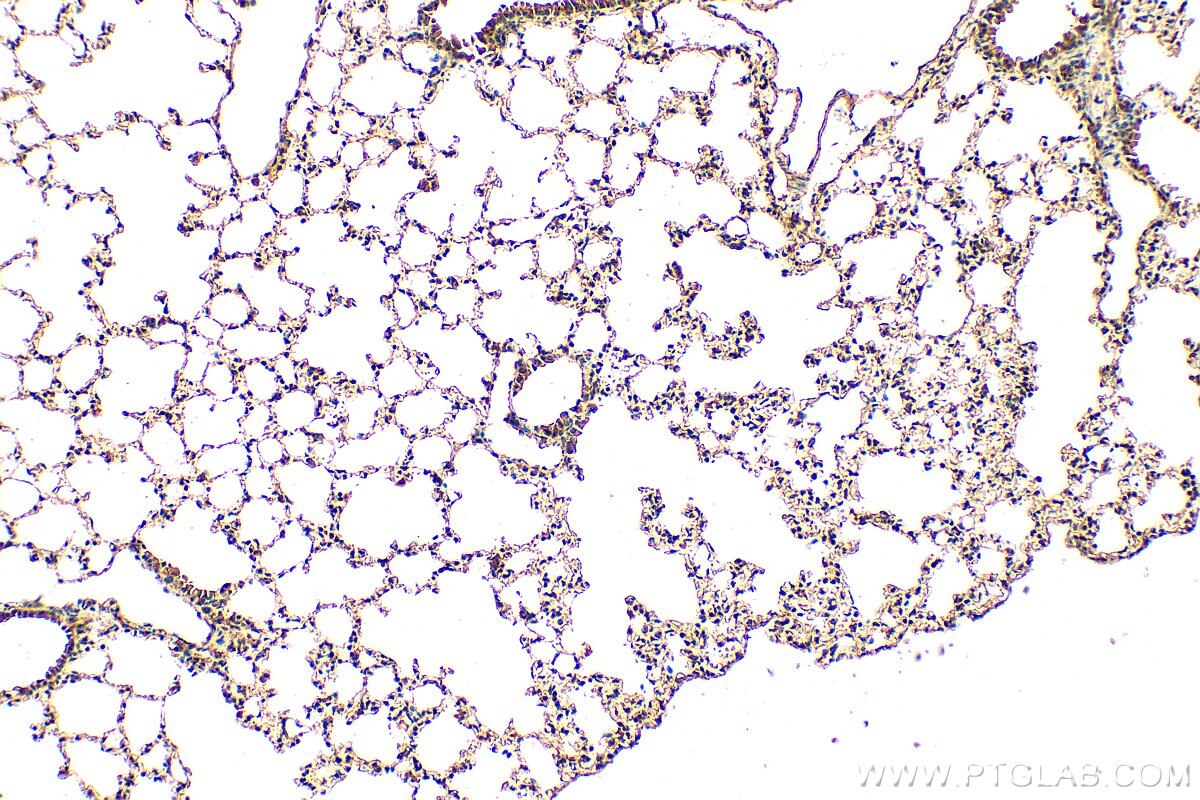 Immunohistochemistry (IHC) staining of mouse lung tissue using CLEC1A Polyclonal antibody (13394-1-AP)