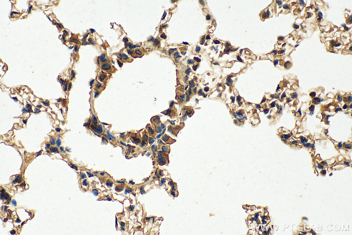 Immunohistochemistry (IHC) staining of mouse lung tissue using CLEC1A Polyclonal antibody (13394-1-AP)