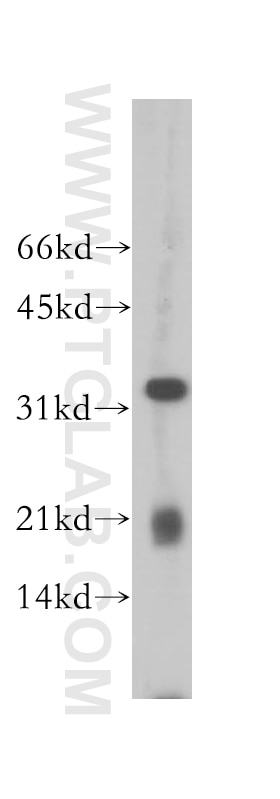 Western Blot (WB) analysis of mouse thymus tissue using CLEC1A Polyclonal antibody (13394-1-AP)