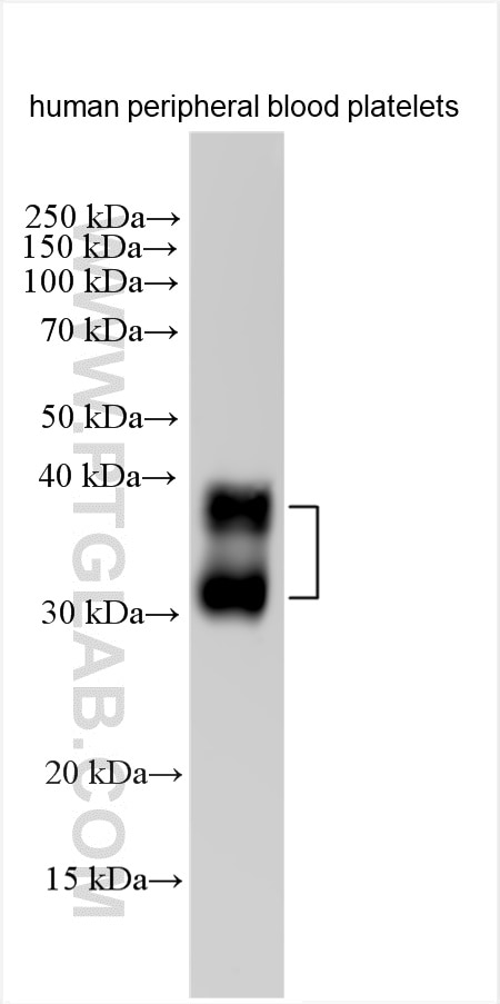 Western Blot (WB) analysis of human peripheral blood platelets using CLEC2/CLEC1B Polyclonal antibody (12814-1-AP)