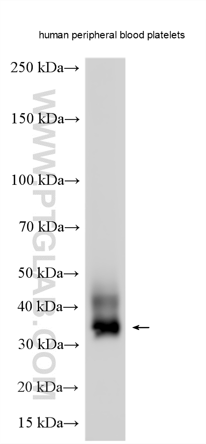 WB analysis using 12814-1-AP Western Blot (WB) analysis of various lysates using CLEC2/CLEC1B Polyclonal antibody (12814-1-AP)
