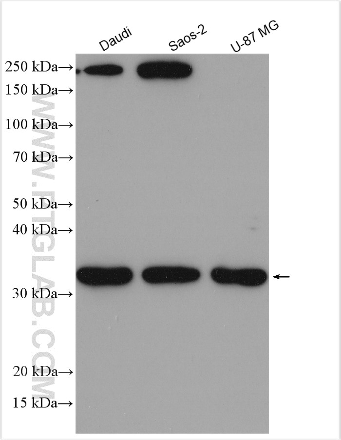 Western Blot (WB) analysis of various lysates using CLEC2D Polyclonal antibody (13188-1-AP)