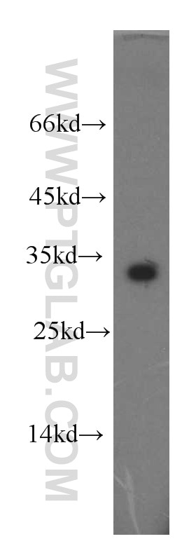 Western Blot (WB) analysis of Jurkat cells using CLEC2D Polyclonal antibody (13188-1-AP)