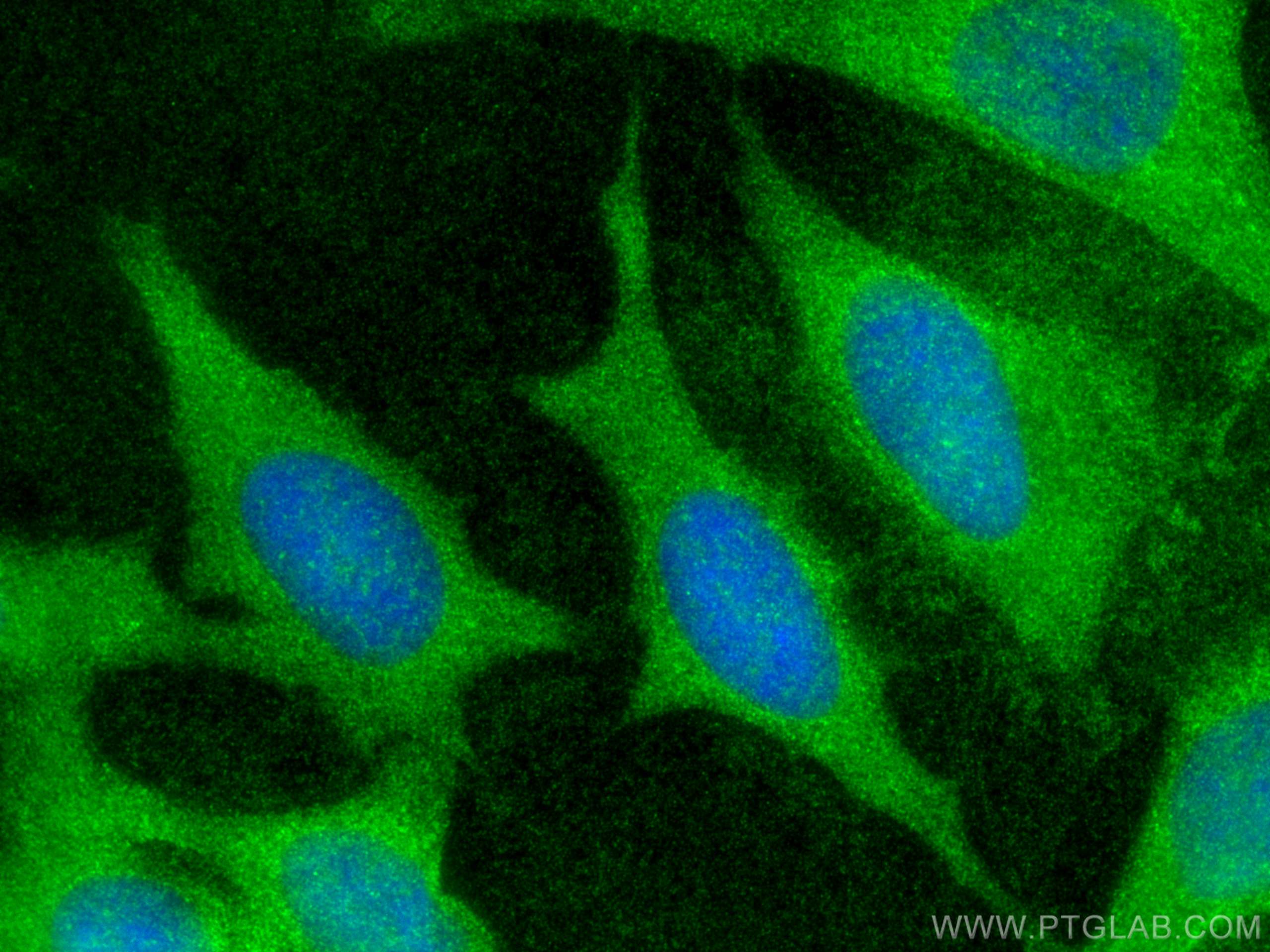 Immunofluorescence (IF) / fluorescent staining of HeLa cells using Tetranectin Polyclonal antibody (20311-1-AP)