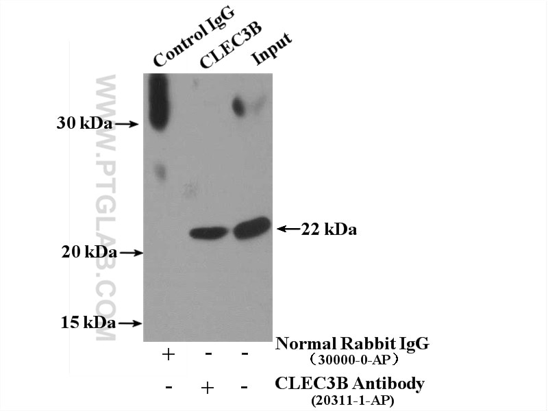 Immunoprecipitation (IP) experiment of human plasma using CLEC3B Polyclonal antibody (20311-1-AP)